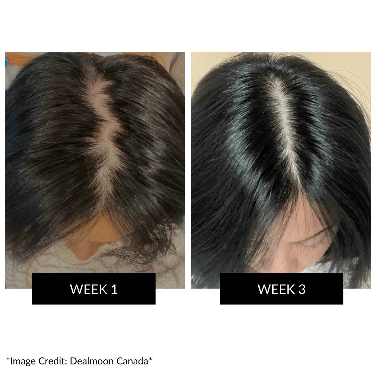  CurrentBody Skin LED Hair Regrowth Device (2).jpg 