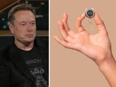 Elon Musk-mozdani-implant-prvi-ljudski-pacijent.jpeg 